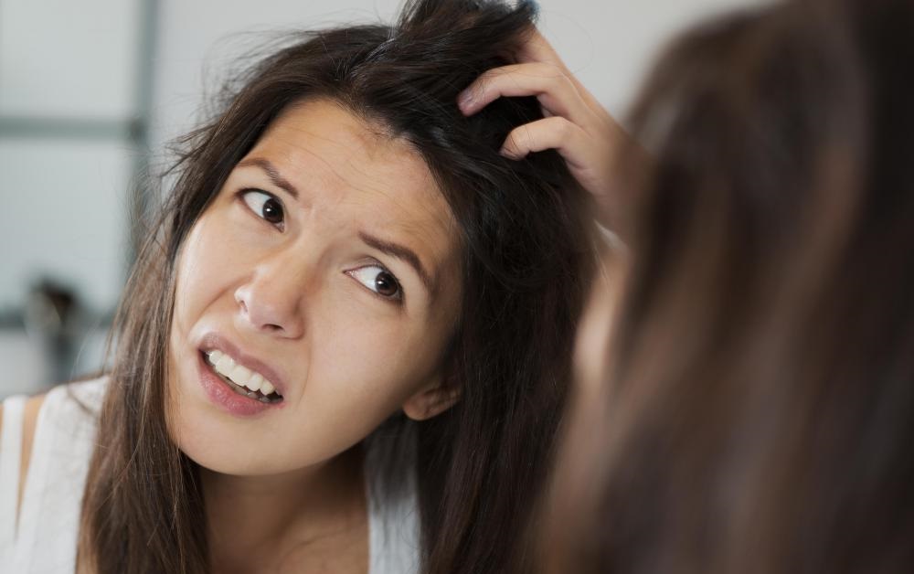 7 Best Home Remedies To Remove Dandruff Forever