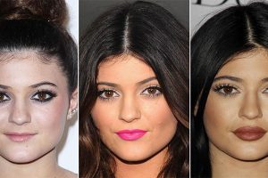 Cosmetic Procedure Celebrities Use