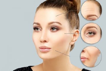Should I Get Botox 5 Key Questions to Ask Before Getting Botox