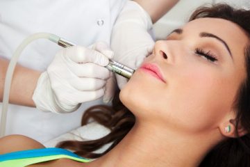 Laser Acne Scar Removal 101: 6 Tips from the Experts