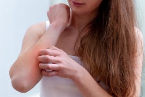 Psoriasis and Its Treatment