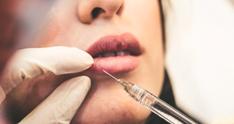 All You Need to Know About Lip Injections.