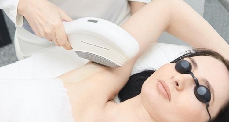 5 Types of Laser Hair Removal Treatments for Women