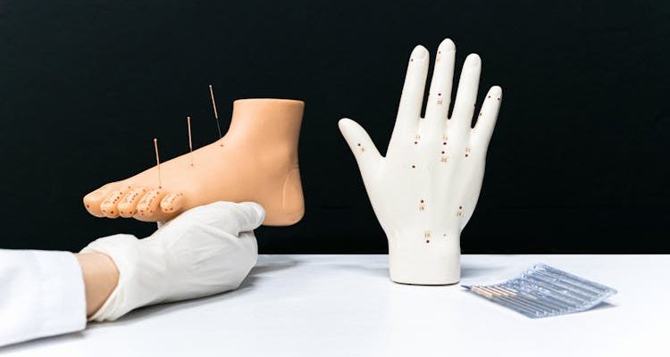 Acupuncture.