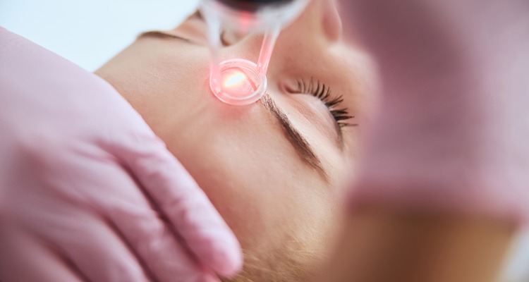 Laser technology skin treatment